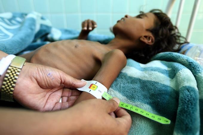 Liên hợp quốc viện trợ khẩn cấp 100 triệu USD chống lại nạn đói
