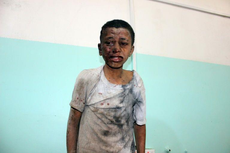 Tấn công đẫm máu tại Yemen: Ít nhất 29 trẻ em thiệt mạng